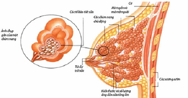 Phát hiện cục cứng ở vú